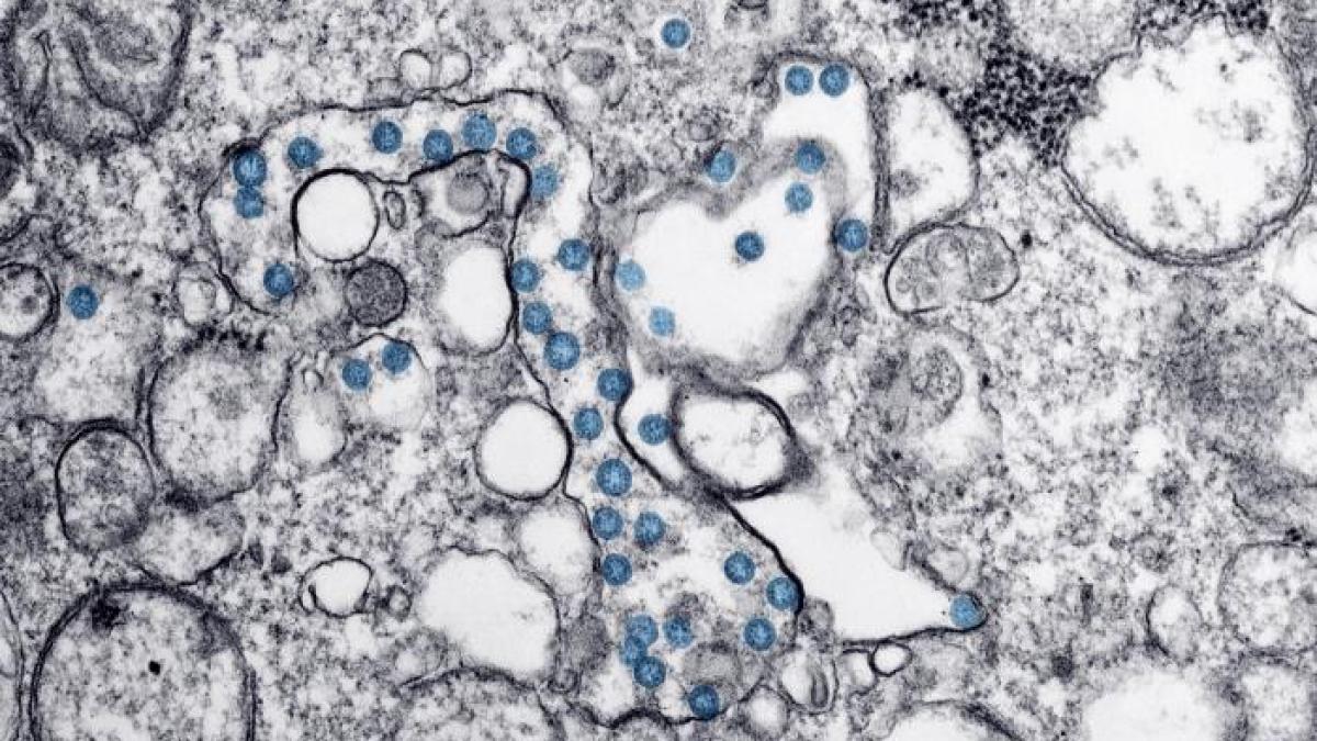 coronaviruspic